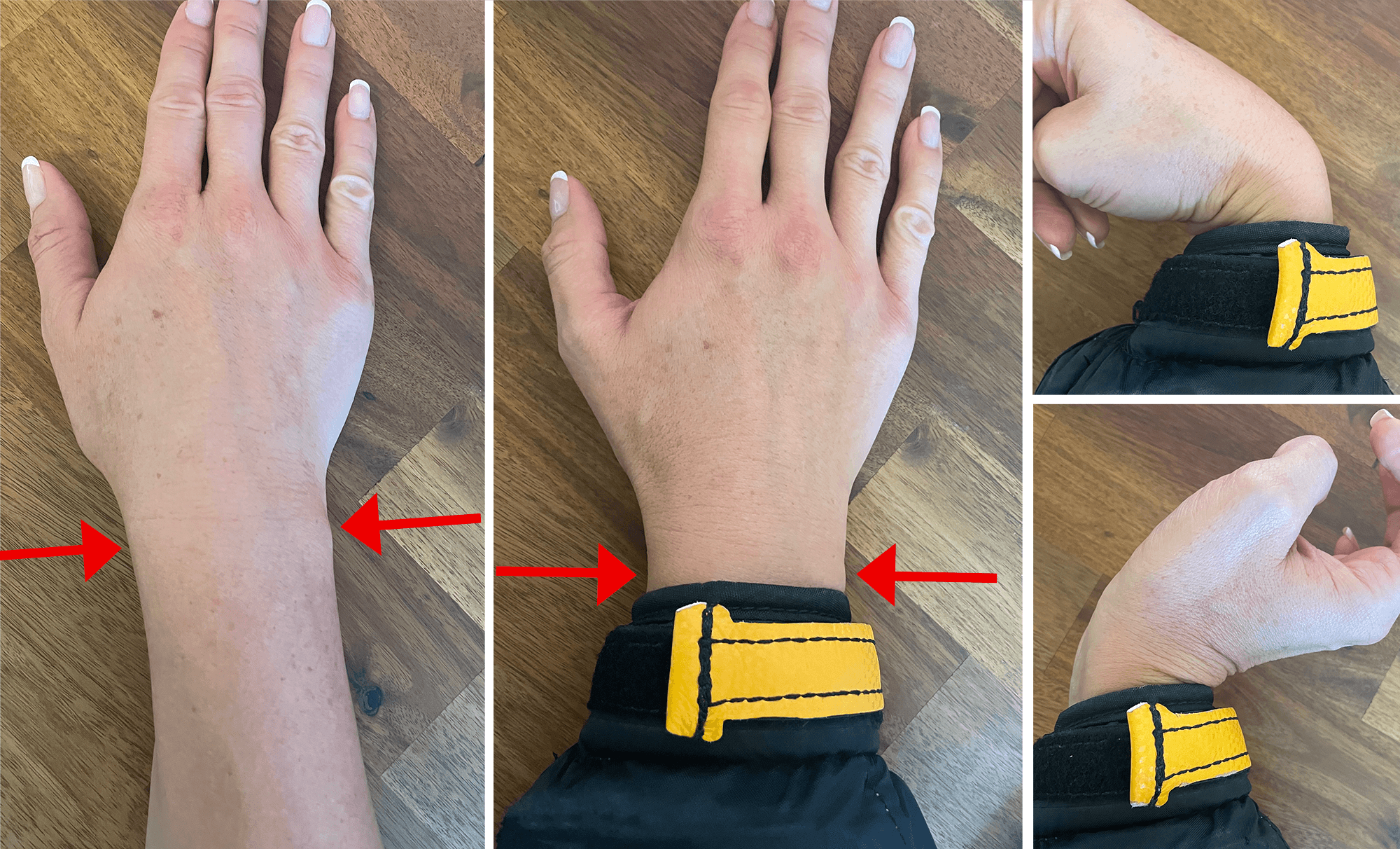 Forearm Length